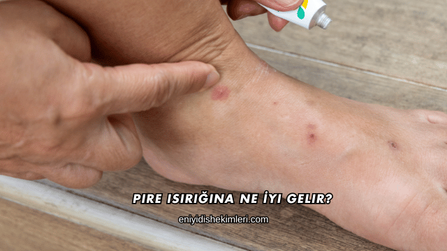 Pire Isırığına Ne İyi Gelir?