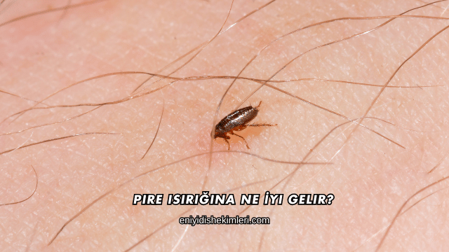 Pire Isırığına Ne İyi Gelir?