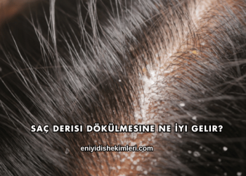 Saç Derisi Dökülmesine Ne İyi Gelir?