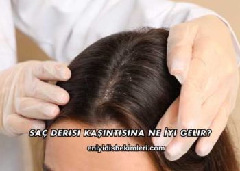 Saç Derisi Kaşıntısına Ne İyi Gelir?