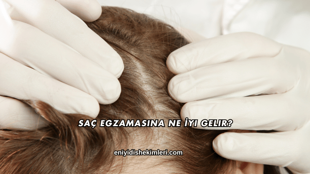 Saç Egzamasına Ne İyi Gelir?