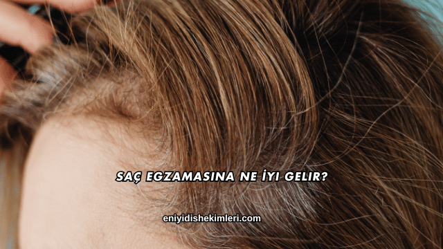 Saç Egzamasına Ne İyi Gelir?