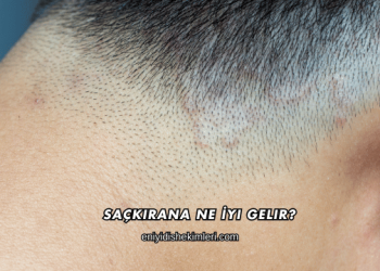 Saçkırana Ne İyi Gelir?