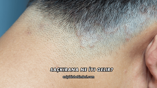 Saçkırana Ne İyi Gelir?