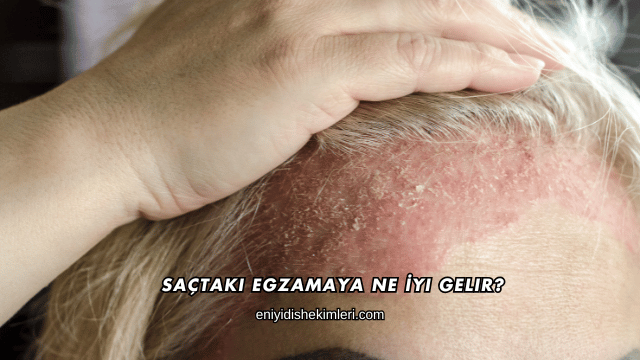 Saçtaki Egzamaya Ne İyi Gelir?