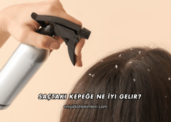 Saçtaki Kepeğe Ne İyi Gelir?