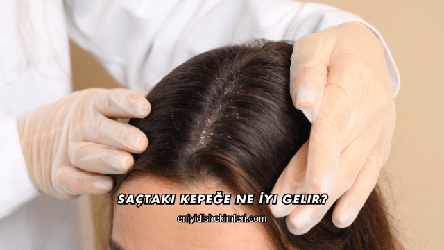 Saçtaki Kepeğe Ne İyi Gelir?