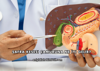 Safra Kesesi Çamuruna Ne İyi Gelir?