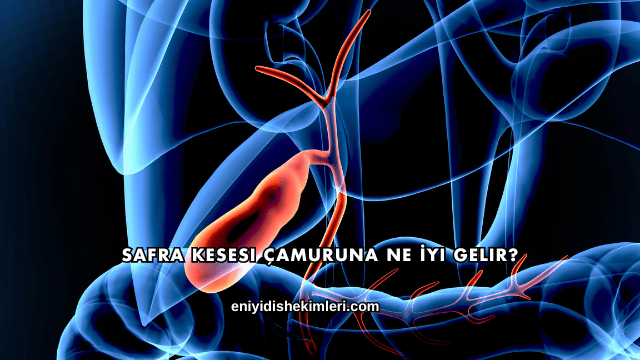 Safra Kesesi Çamuruna Ne İyi Gelir?