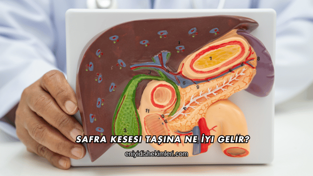 Safra Kesesi Taşına Ne İyi Gelir?