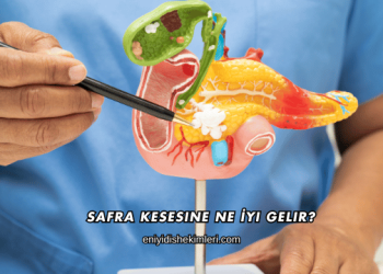 Safra Kesesine Ne İyi Gelir?