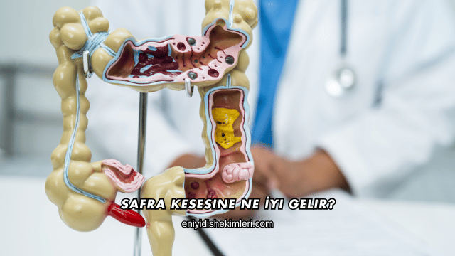 Safra Kesesine Ne İyi Gelir?