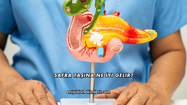 Safra Taşına Ne İyi Gelir?