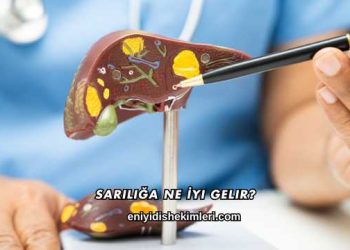 Sarılığa Ne İyi Gelir?