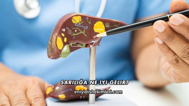 Sarılığa Ne İyi Gelir?