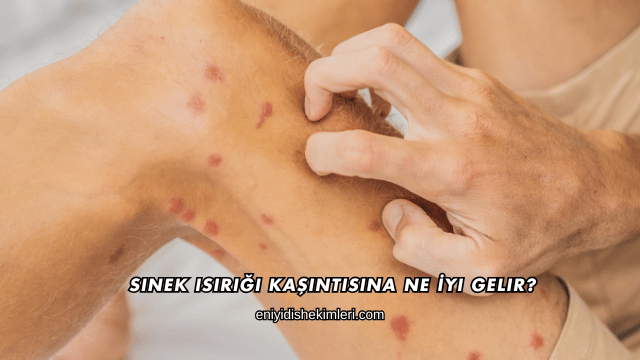Sinek Isırığı Kaşıntısına Ne İyi Gelir?