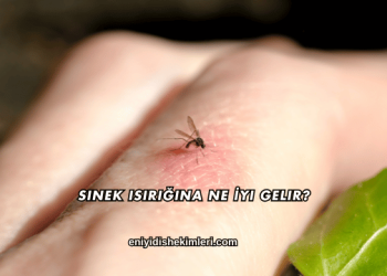 Sinek Isırığına Ne İyi Gelir?
