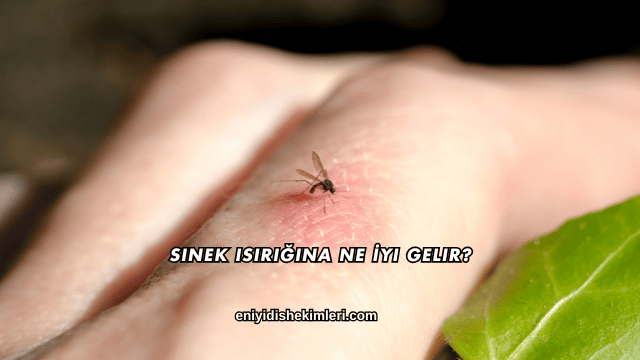 Sinek Isırığına Ne İyi Gelir?