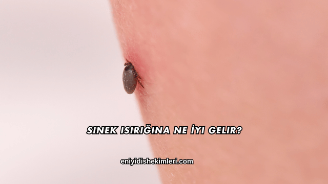 Sinek Isırığına Ne İyi Gelir?
