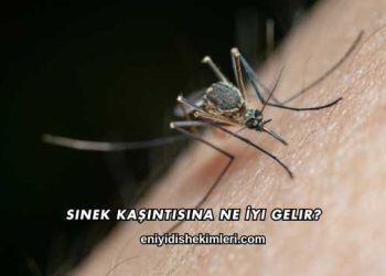Sinek Kaşıntısına Ne İyi Gelir?