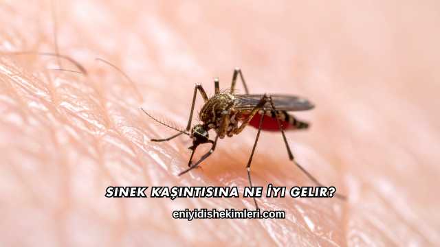 Sinek Kaşıntısına Ne İyi Gelir?