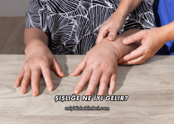 Şişliğe Ne İyi Gelir?