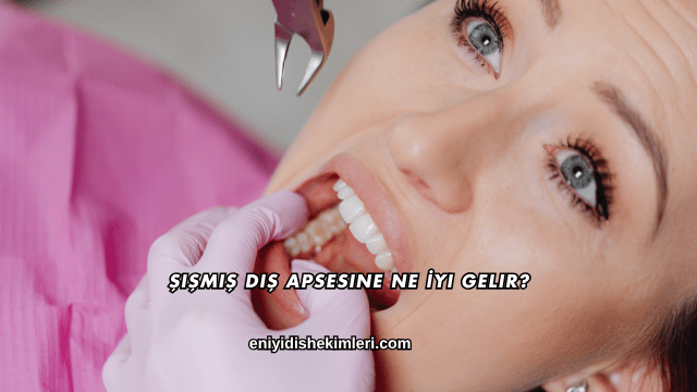 Şişmiş Diş Apsesine Ne İyi Gelir?