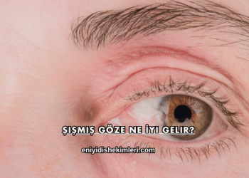 Şişmiş Göze Ne İyi Gelir?