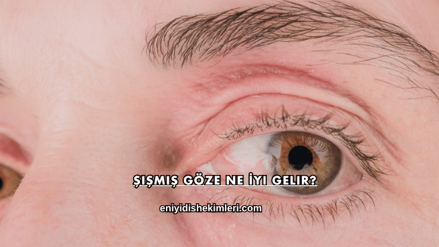 Şişmiş Göze Ne İyi Gelir?