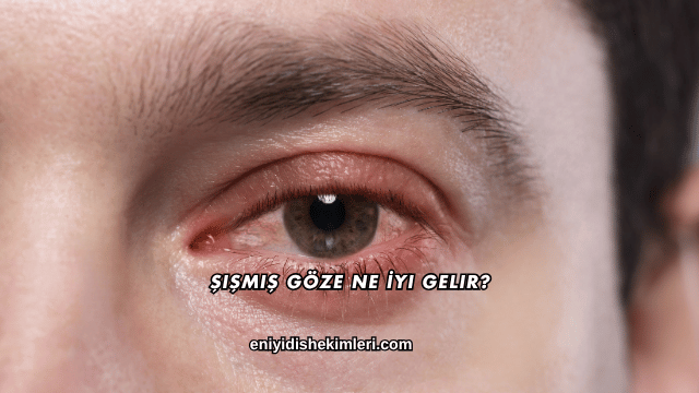 Şişmiş Göze Ne İyi Gelir?