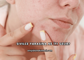 Sivilce Yarasına Ne İyi Gelir?