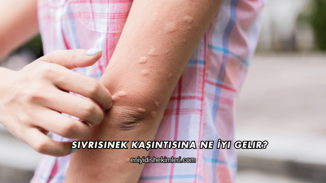 Sivrisinek Kaşıntısına Ne İyi Gelir?