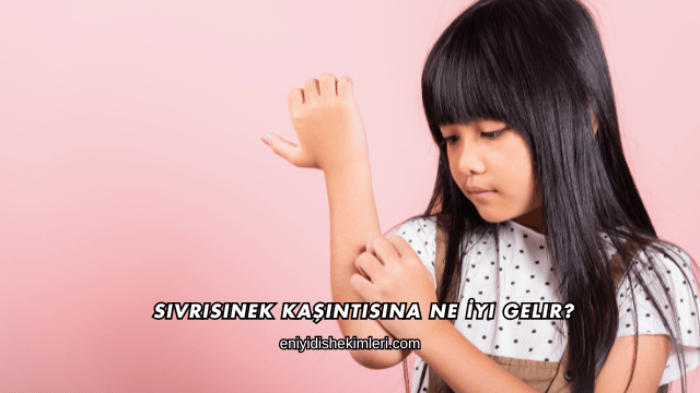 Sivrisinek Kaşıntısına Ne İyi Gelir?