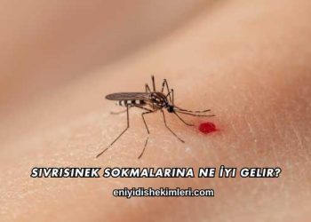 Sivrisinek Sokmalarına Ne İyi Gelir?