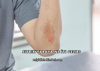 Sıyrık Yaraya Ne İyi Gelir?