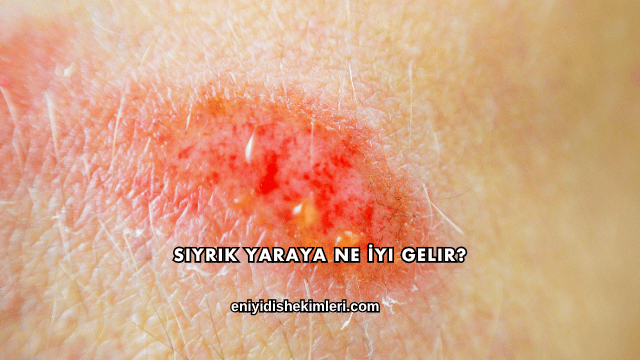 Sıyrık Yaraya Ne İyi Gelir?
