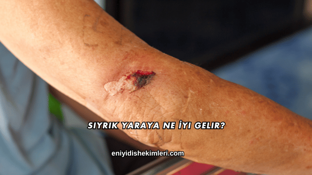 Sıyrık Yaraya Ne İyi Gelir?