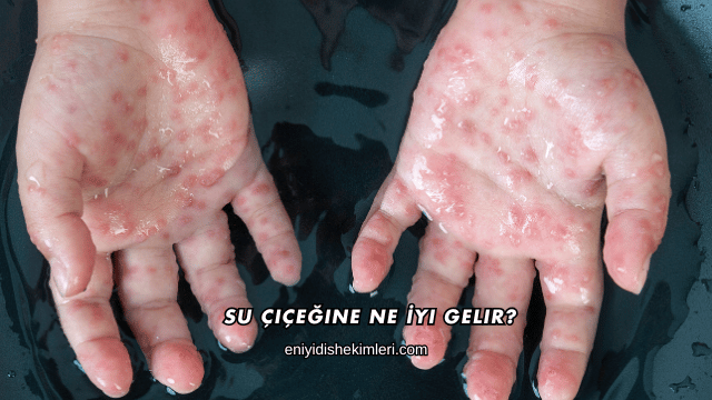 Su Çiçeğine Ne İyi Gelir?