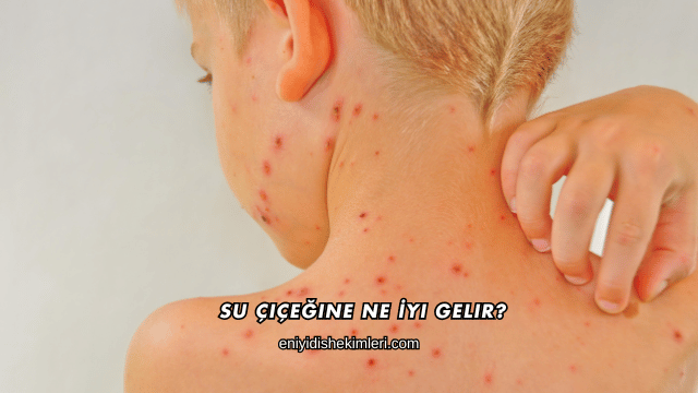 Su Çiçeğine Ne İyi Gelir?