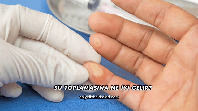 Su Toplamasına Ne İyi Gelir?