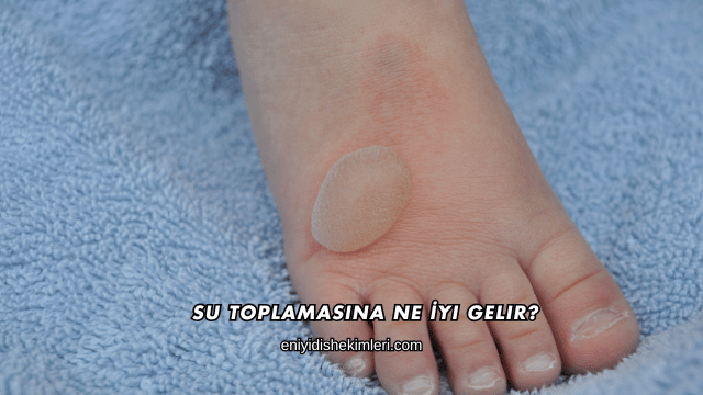 Su Toplamasına Ne İyi Gelir?