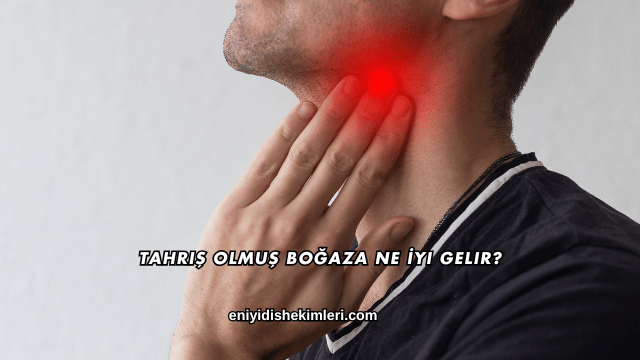 Tahriş Olmuş Boğaza Ne İyi Gelir?