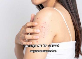 Tahrişe Ne İyi Gelir?