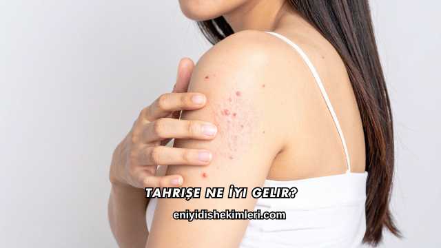 Tahrişe Ne İyi Gelir?