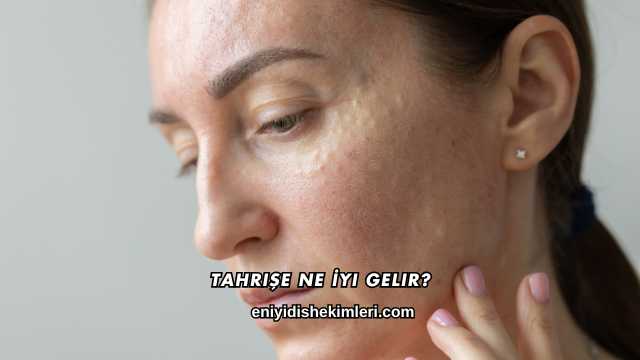 Tahrişe Ne İyi Gelir?