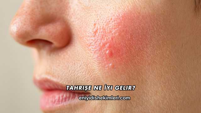 Tahrişe Ne İyi Gelir?