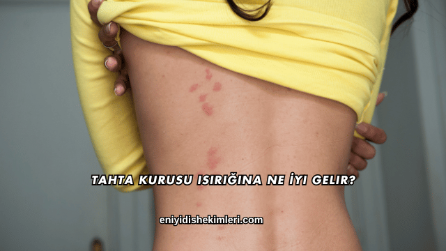 Tahta Kurusu Isırığına Ne İyi Gelir?