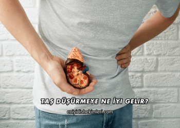 Taş Düşürmeye Ne İyi Gelir?