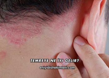 Temreye Ne İyi Gelir?