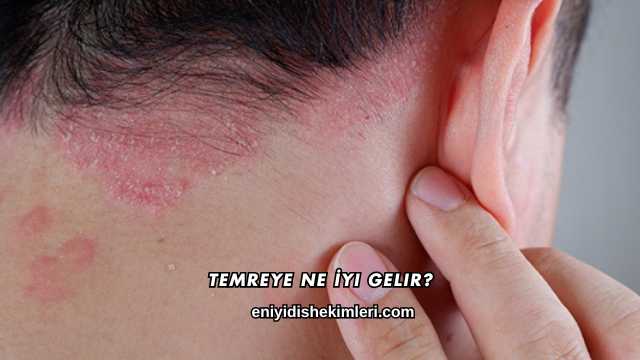 Temreye Ne İyi Gelir?